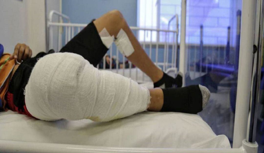 Quemados por pólvora en Caldas