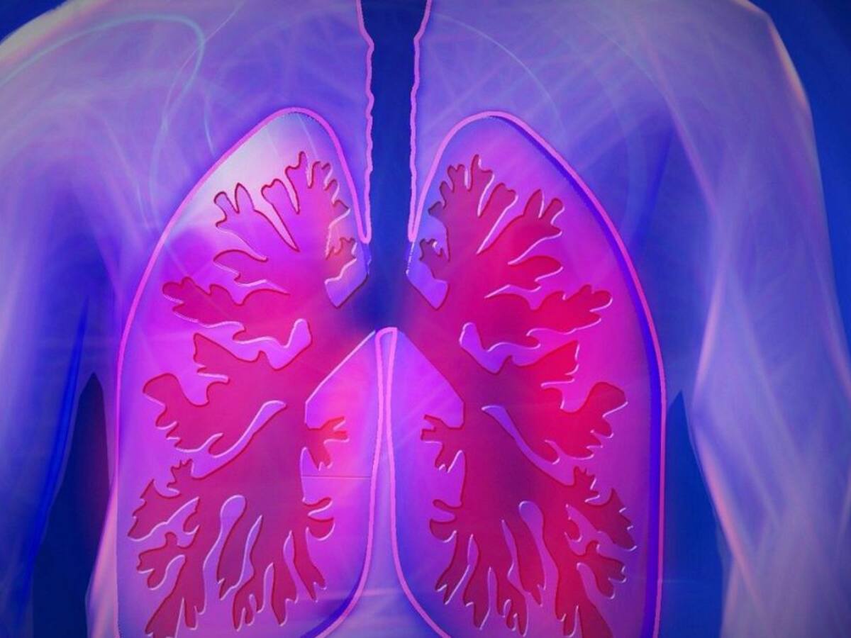 Enfermedad Pulmonar Obstructiva Crónica EPOC