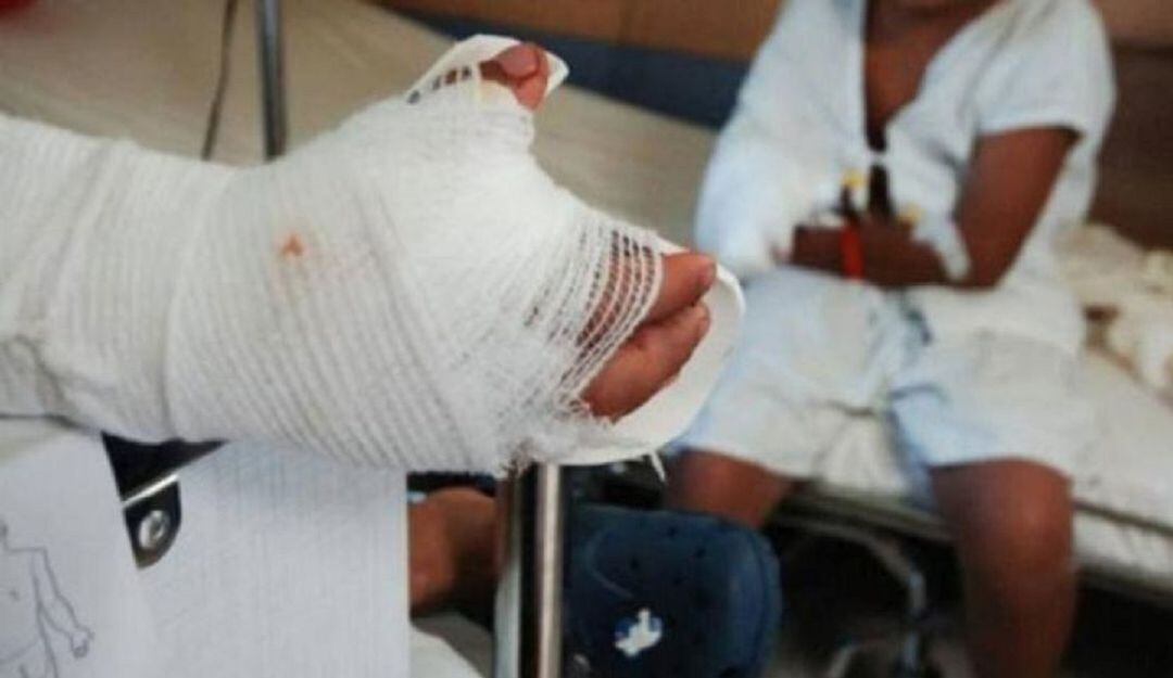 En el Tolima 35 personas se han quemado con pólvora este diciembre. 