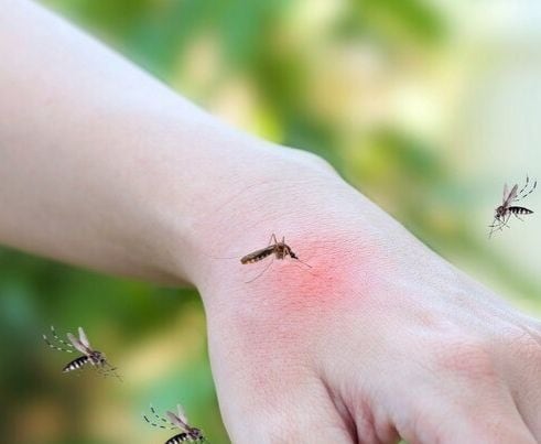 Foto suministrada/ Alcaldía de Manizales