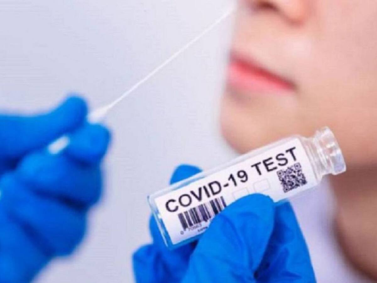 Hasta 10 veces se han incrementado los casos de COVID-19 en Armenia