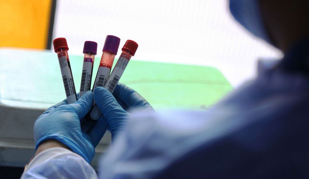 La institución publicó las secuencias de péptidos que utiliza en este prototipo