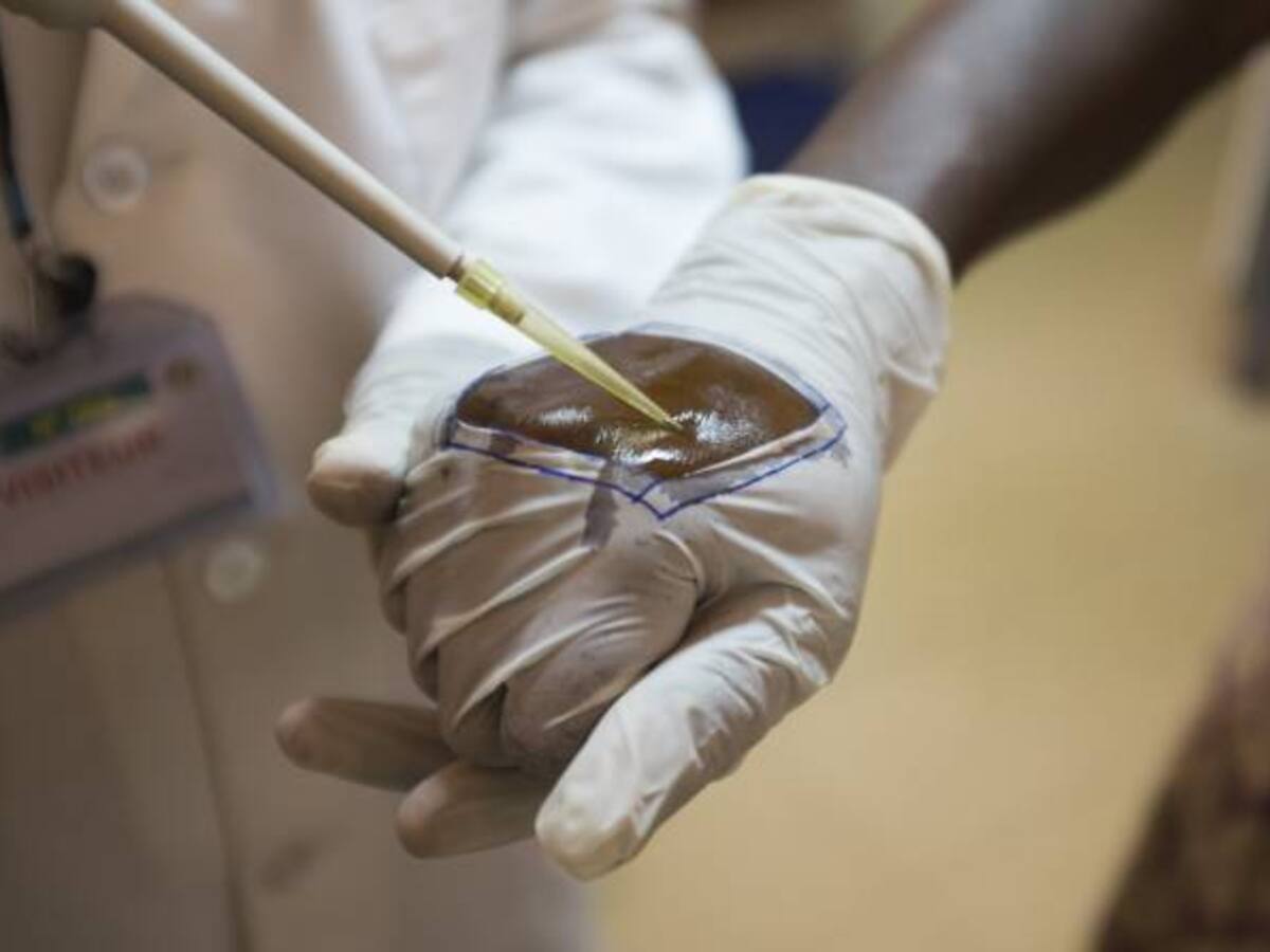 OMS dice que malaria se dispara en Venezuela y Colombia por razones distintas