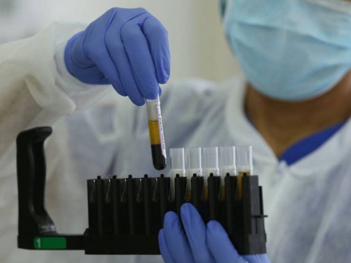 Coronavirus en Cartagena: 76 nuevos casos y no hubo fallecidos