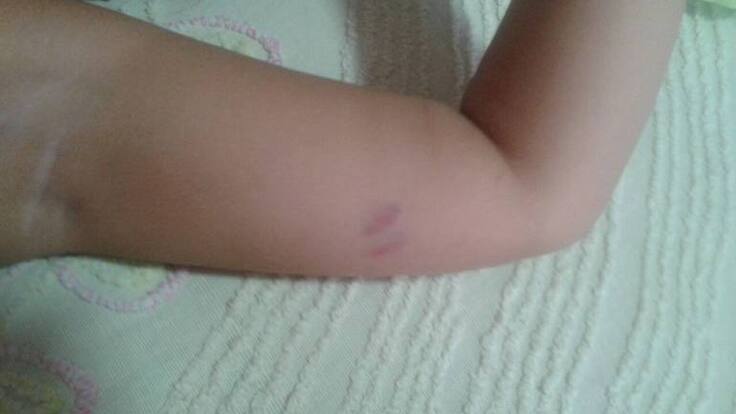 Denuncia agresión a una menor de 8 años de edad en un colegio de Calarcá, Quindío