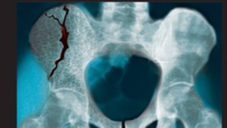 Las crudas imágenes que acompañarán las cajetillas de cigarrillos en 2013