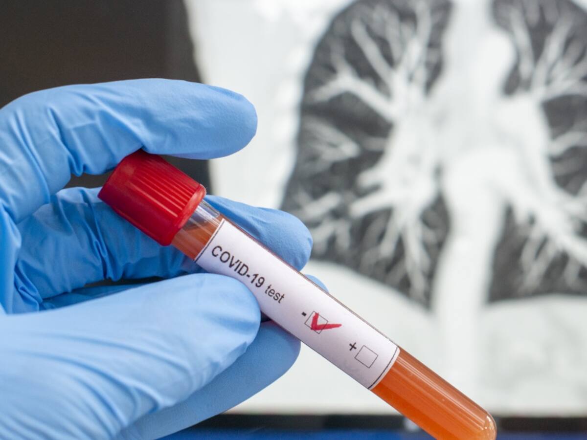 Familiares de la joven sincelejana con COVID-19 no están contagiados