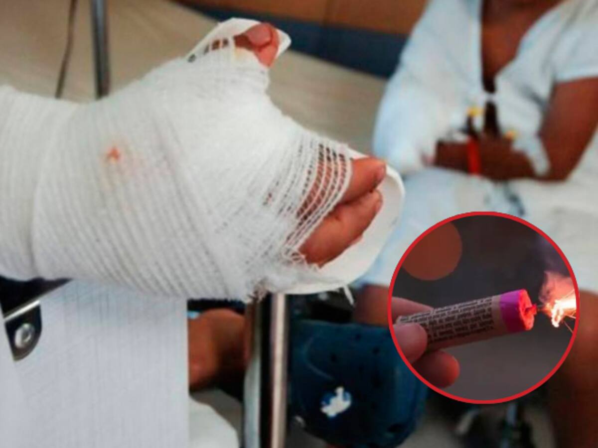 47 personas resultaron lesionadas con pólvora durante diciembre en Santander