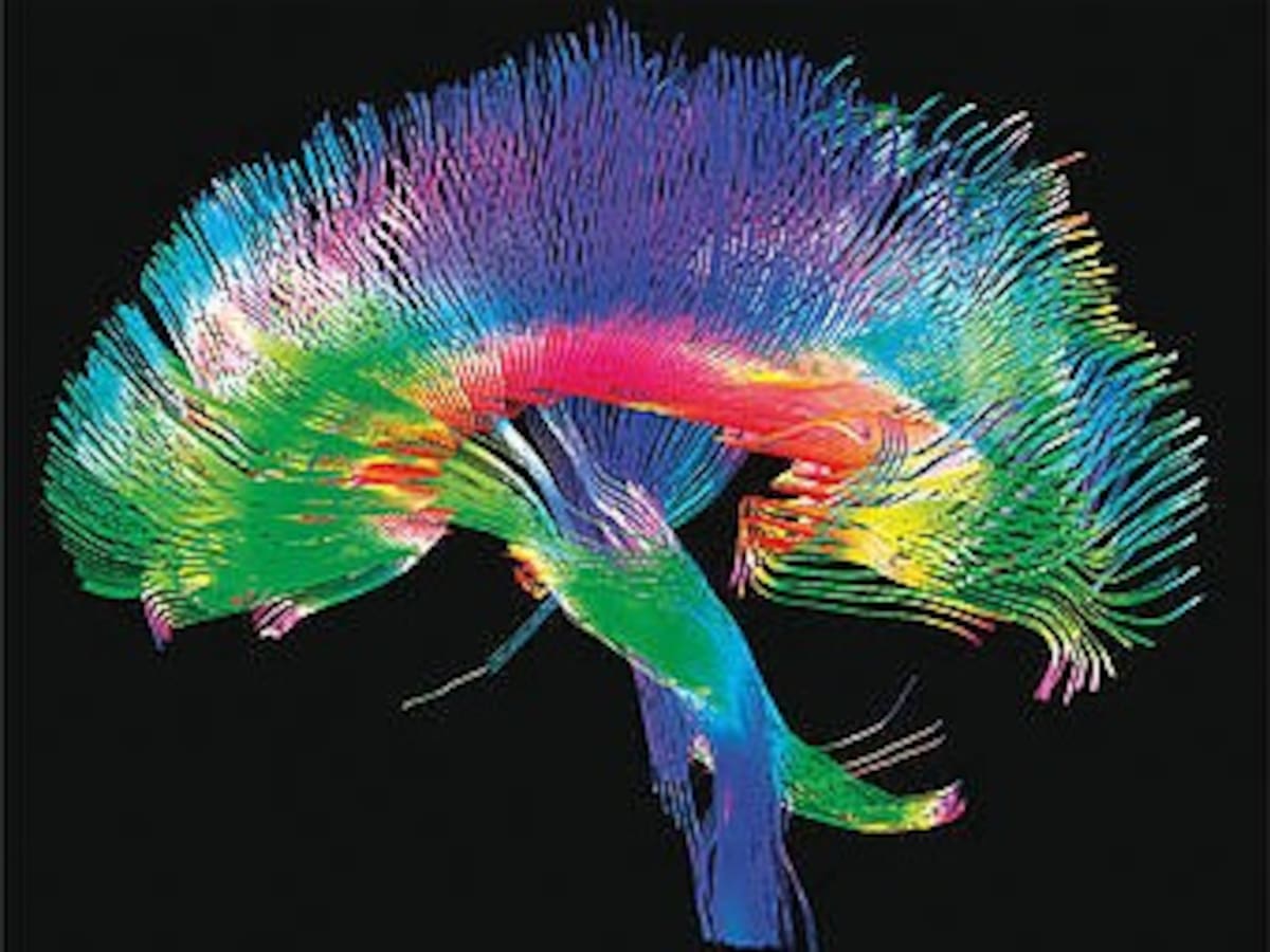 Cerebro en reposo, mucho más interesante que uno despierto