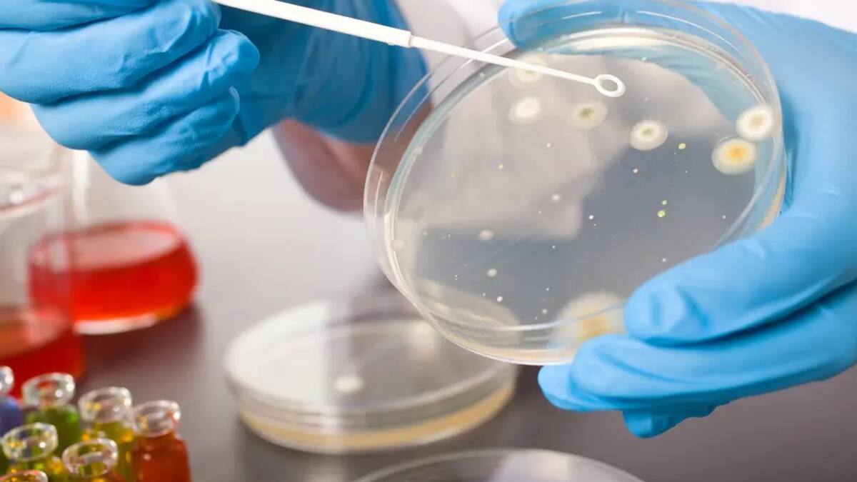 Aumento de casos de tuberculosis el último año en Pasto