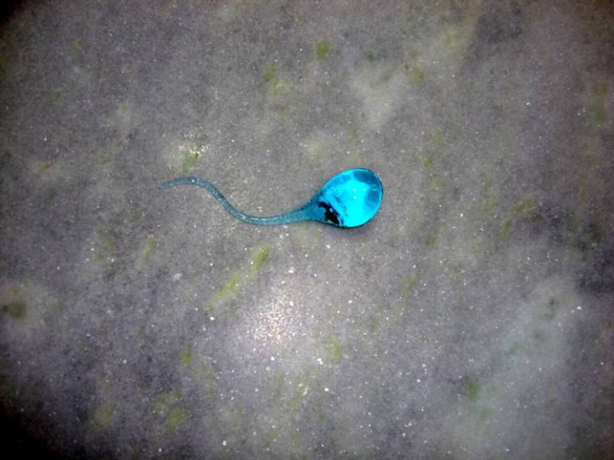 Una novedosa biopsia de testículo para aumentar la fertilidad