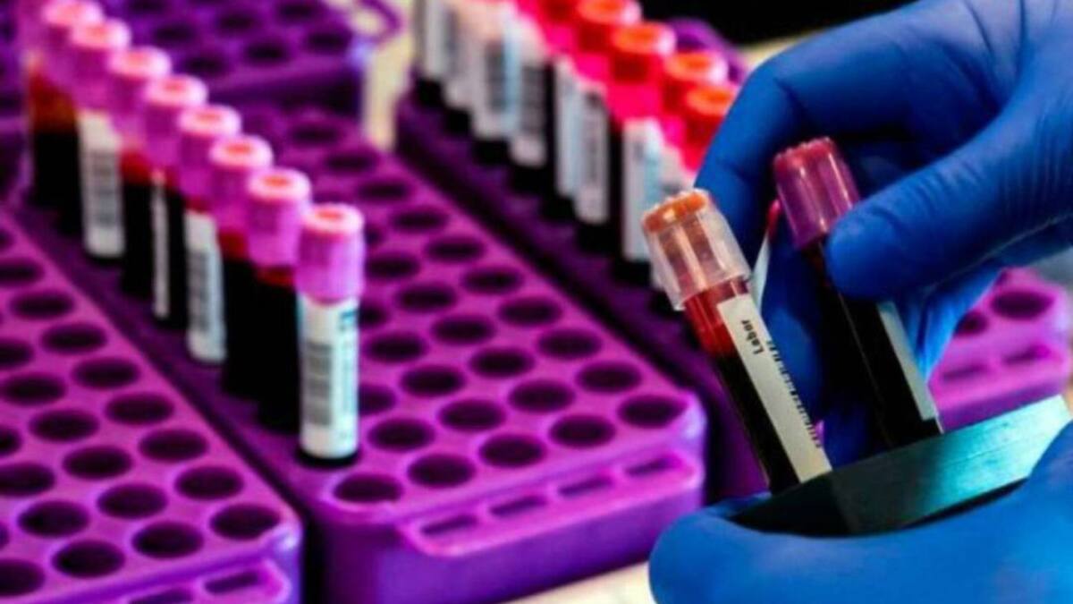 Nuevo conglomerado elevó las cifras de contagio de COVID-19 en Risaralda