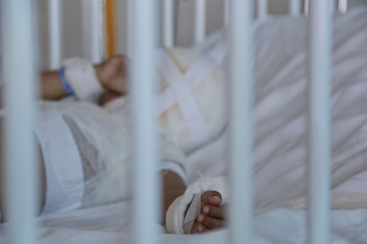 Alerta por quemados con pólvora en Boyacá - Foto: Colprensa - Álvaro Tavera (referencia).