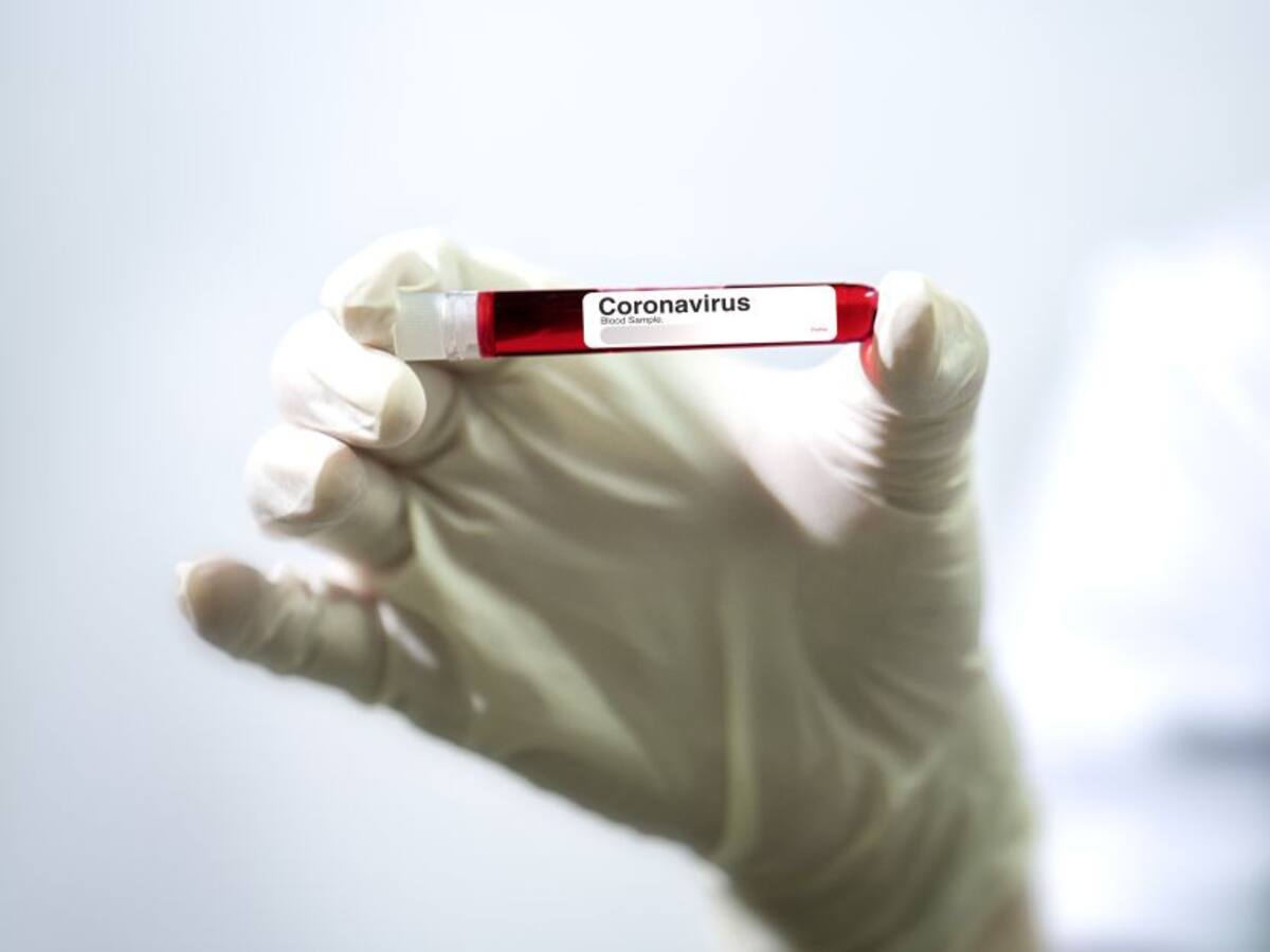 Oposición pide cuentas a Gobierno por manejo de recursos de la pandemia