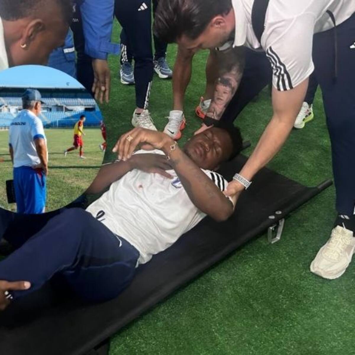 Jorge Luis Pinto sobre ataque a Millonarios: Se ha magnificado mucho esto, se habría podido jugar