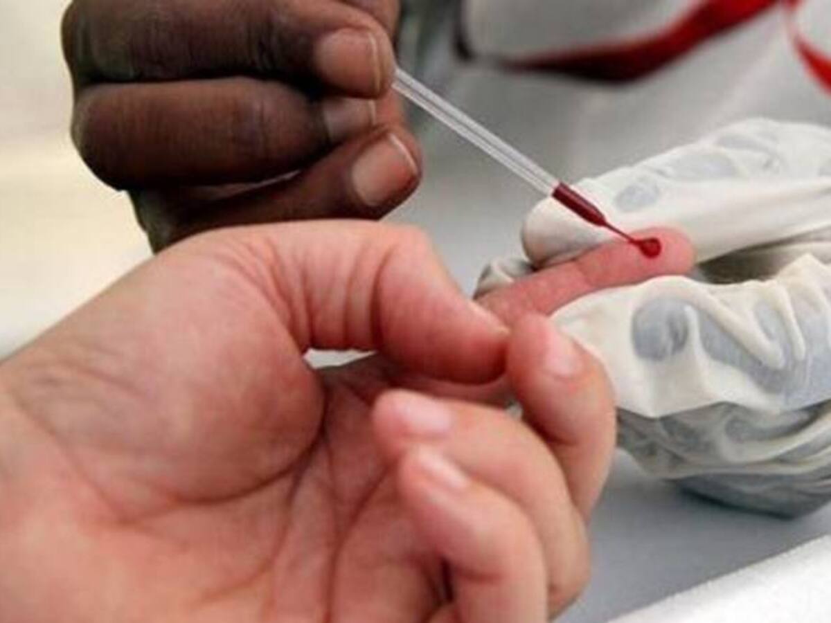 El año pasado aumentaron los casos de VIH notificados en Colombia