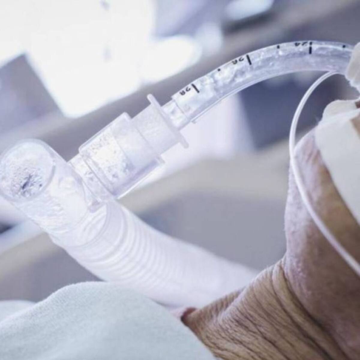 Cada cinco horas muere una persona en Risaralda debido al coronavirus