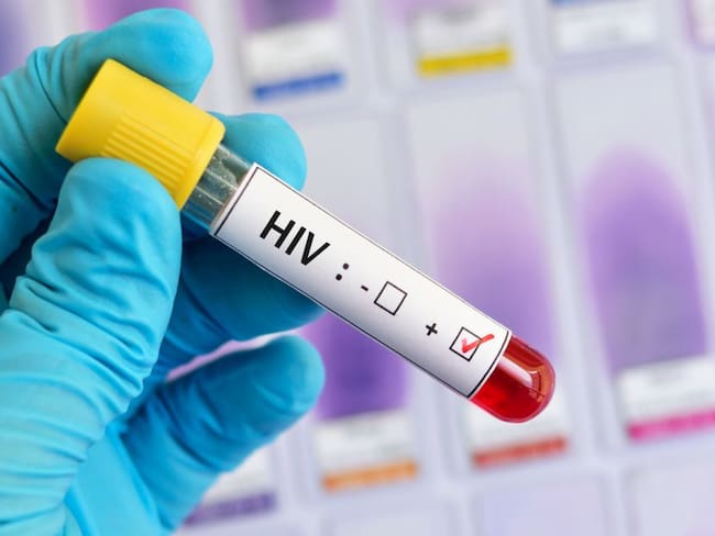En Caldas piden no bajar la guardia para prevenir el VIH/Sida