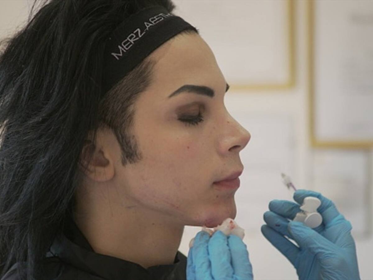 Estas son las cuatro partes de la cara que los hombres suelen operarse