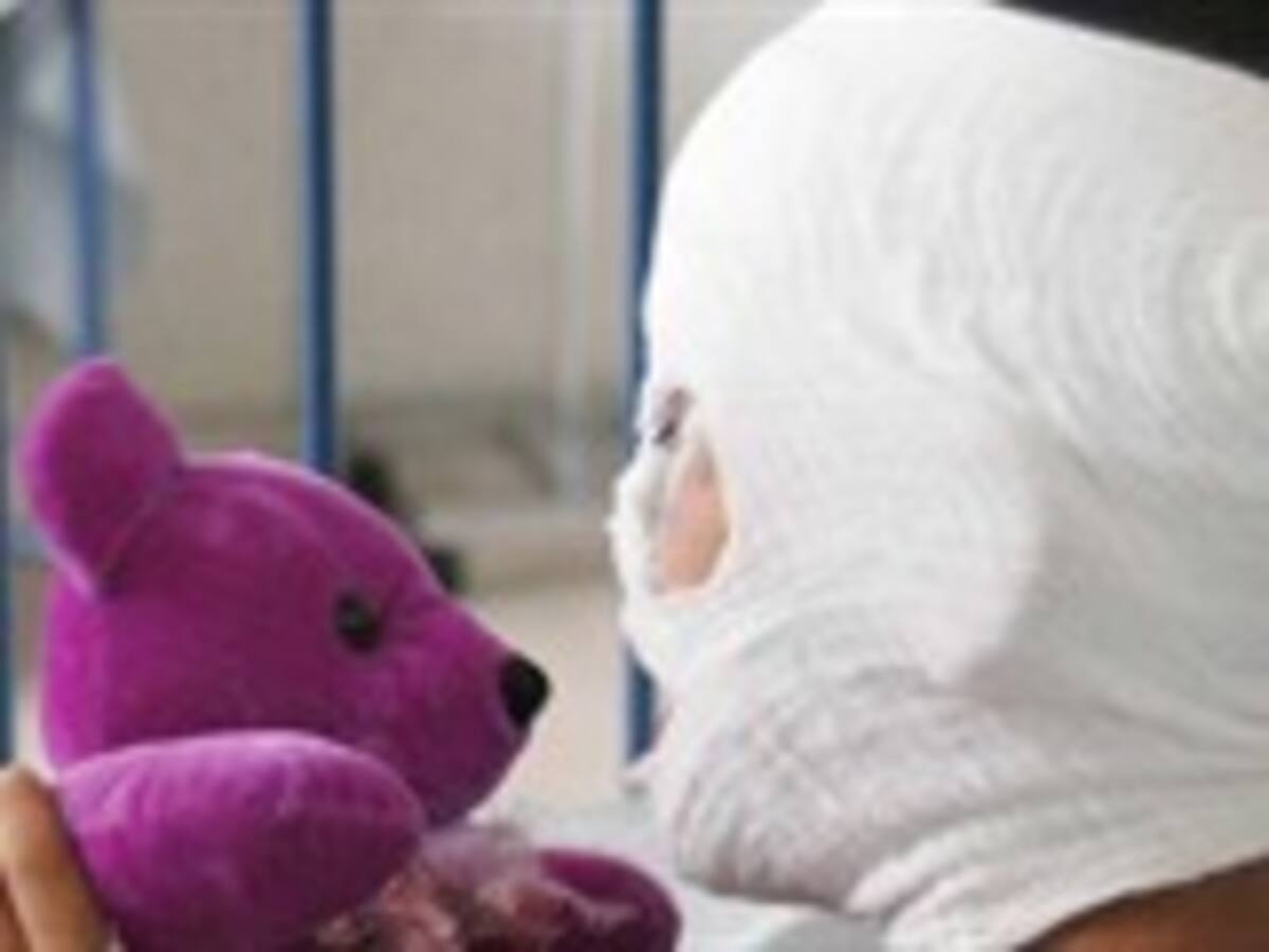 Pese a las campañas de prevención, en Año Nuevo hubo 124 quemados con pólvora: Luis Fernando Correa, de Minprotección Social
