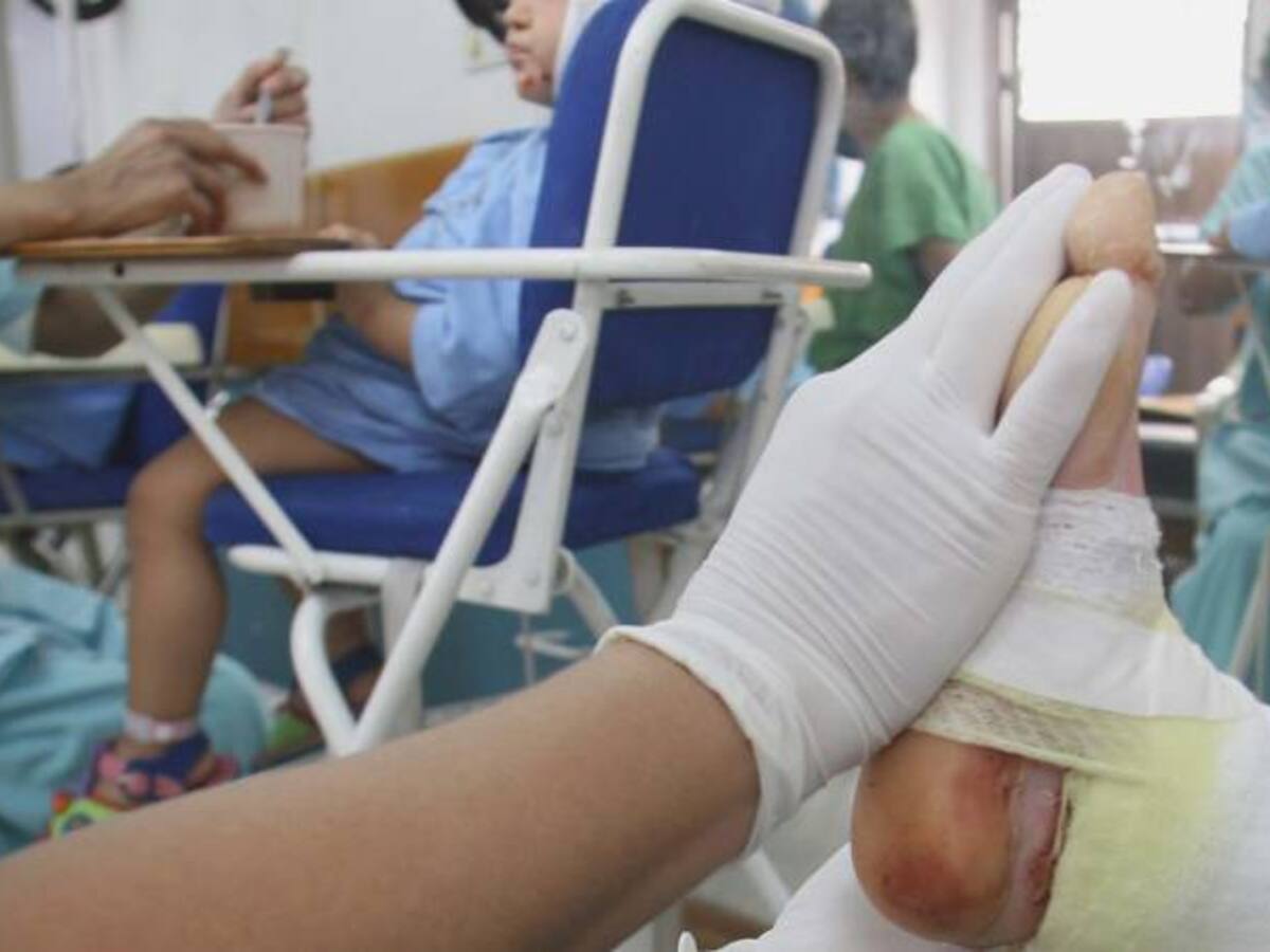 Reportan 422 quemados con pólvora en lo corrido de diciembre