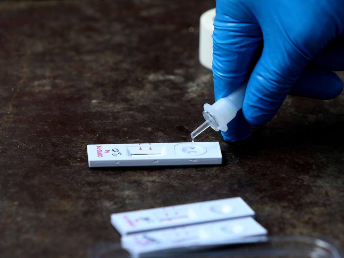 Cargos al alcalde Dau por presuntas irregularidades en compra de pruebas Covid-19