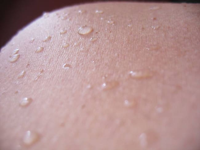 El índice de mujeres con cáncer de piel en Boyacá es más alto que el promedio nacional