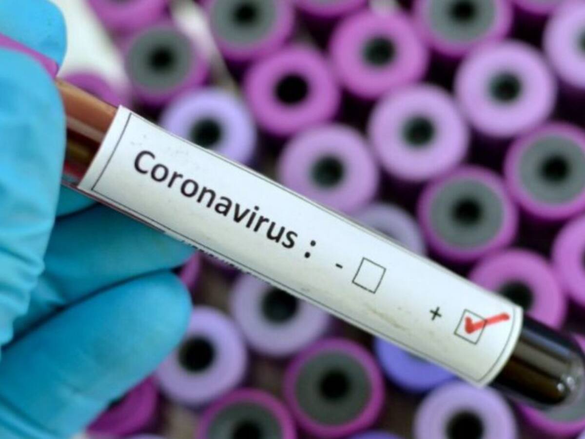 Día con mayor número de contagios de coronavirus en Risaralda