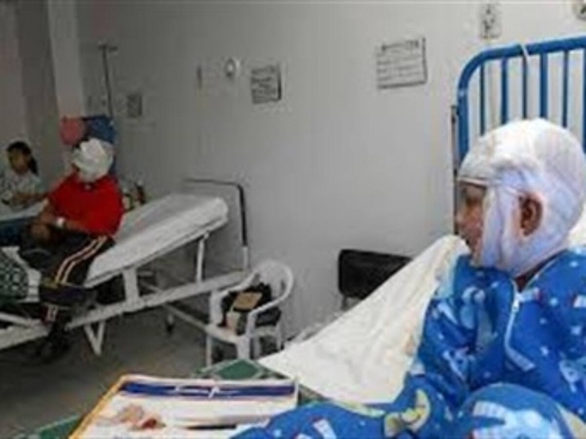 En Antioquia van 41 quemados con pólvora