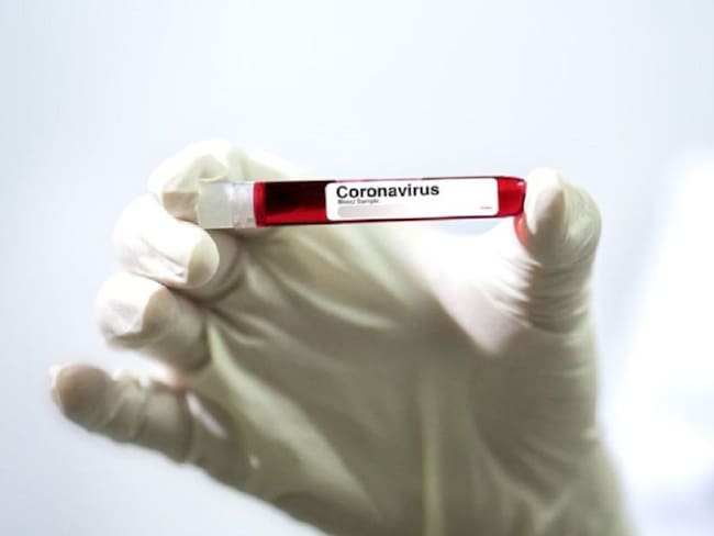 Cuatro pacientes recuperados de Covid-19 en Neiva