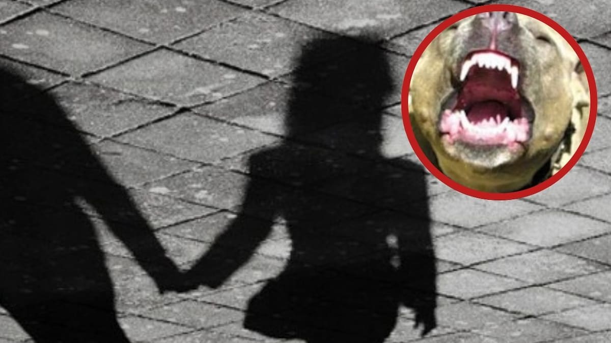 Niña de 2 años fue hospitalizada luego que un perro pitbull la mordiera en Bucaramanga