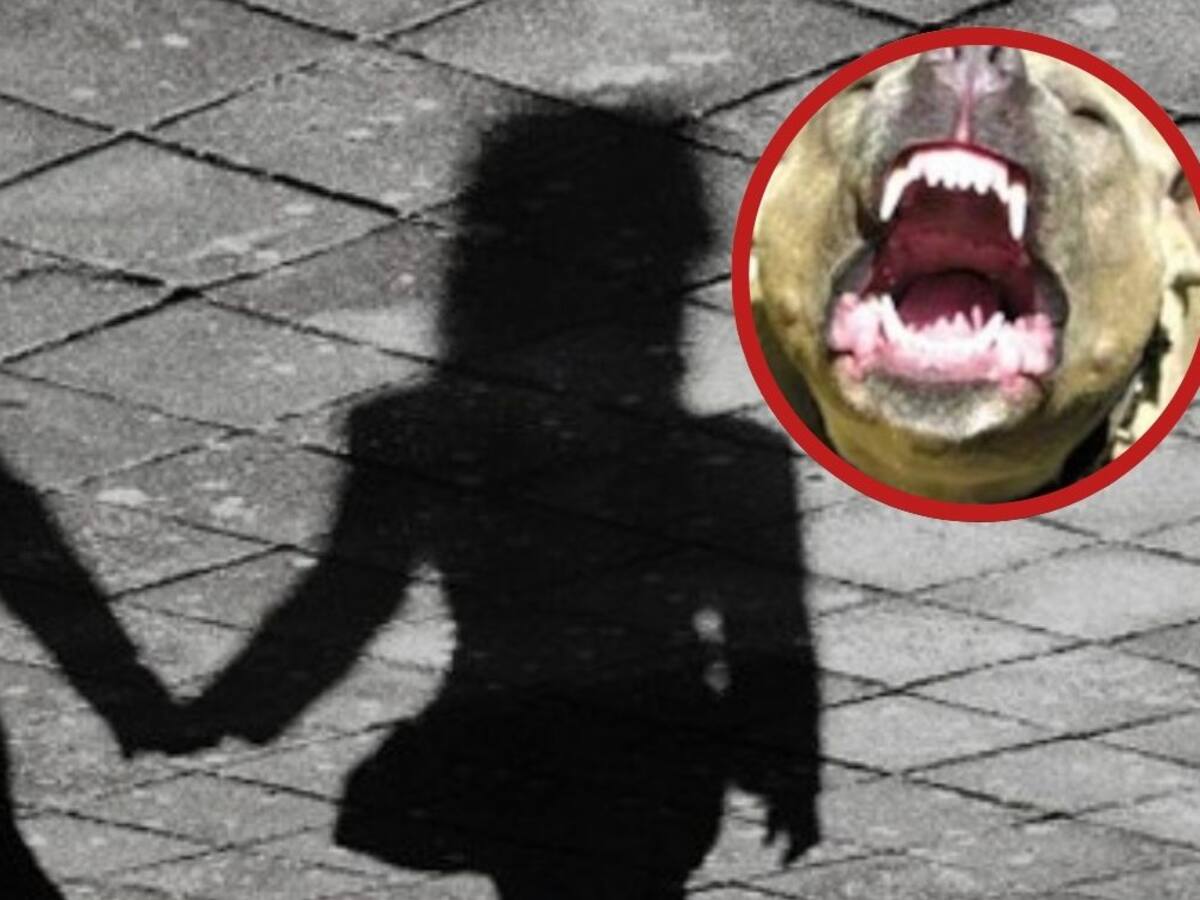 Niña de 2 años fue hospitalizada luego que un perro pitbull la mordiera en Bucaramanga