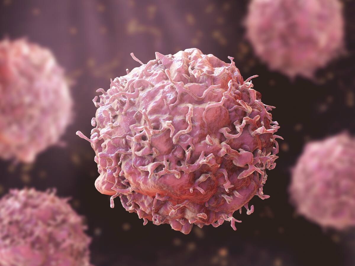 Estos son los síntomas iniciales de cáncer de páncreas que nunca debería ignorar: pueden ser comunes