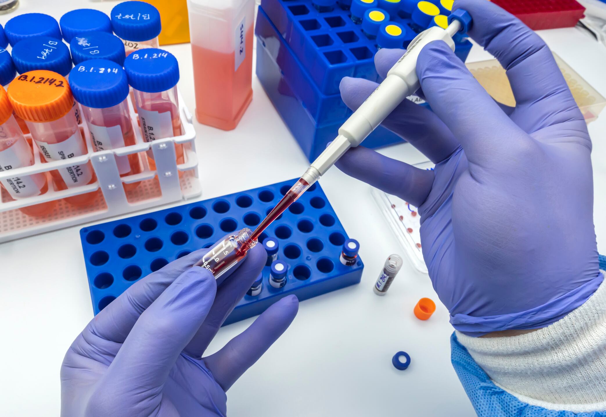 Imagen de referencia de prueba de sangre. Foto: Getty Images.