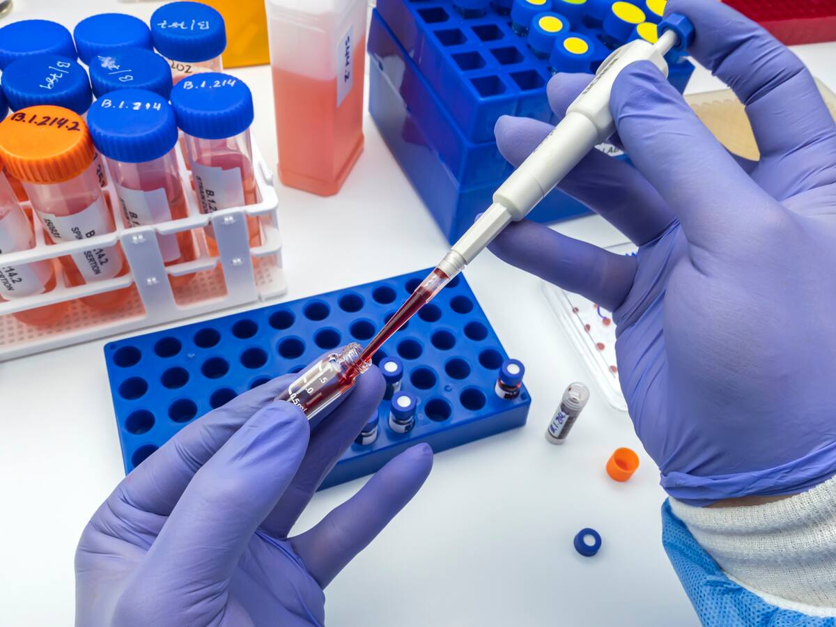 Aprueban análisis de sangre para detectar el cáncer de colon: ¿qué tan efectivo es?