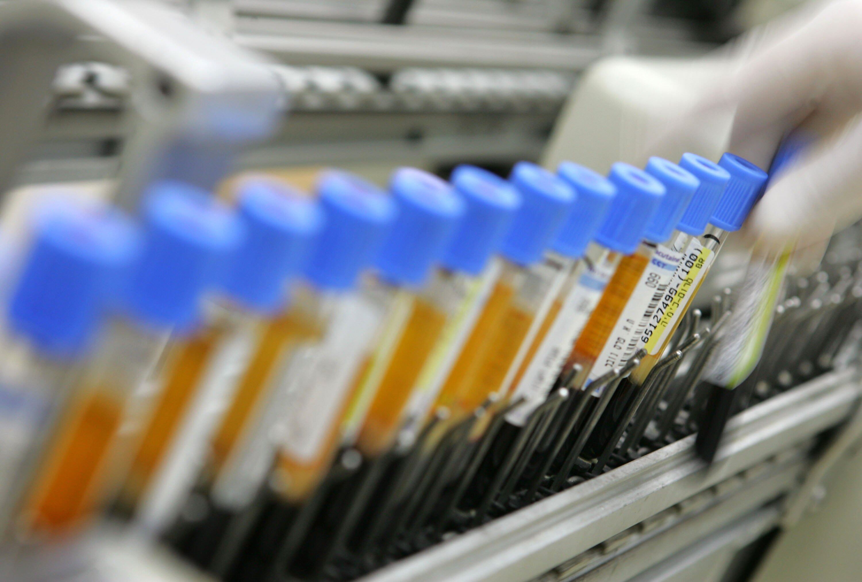 Imagen de referencia de un laboratorio con muestras de gripe aviar. (Photo by David Silverman/Getty Images)