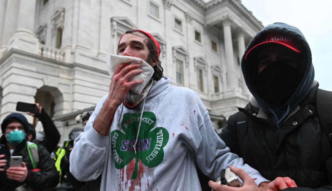 Heridos durante la toma del Capitolio en Washington 