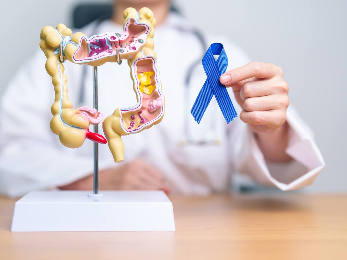 ¿Con qué síntomas se manifiesta el cáncer de colon? Consejos de expertos para prevenirlo