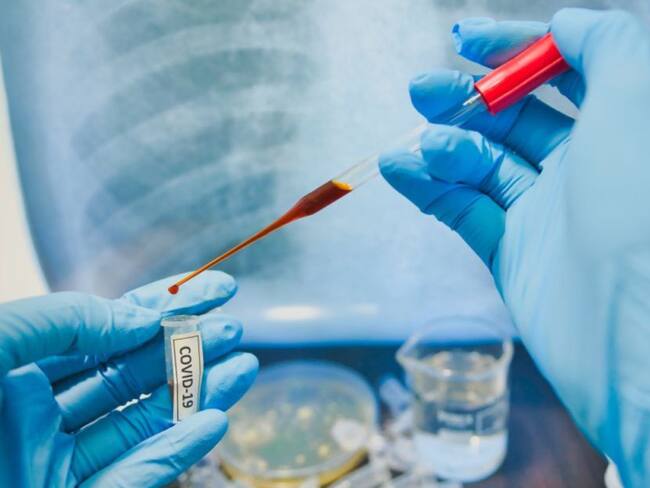 Tres fallecidos y 226 nuevos casos de COVID