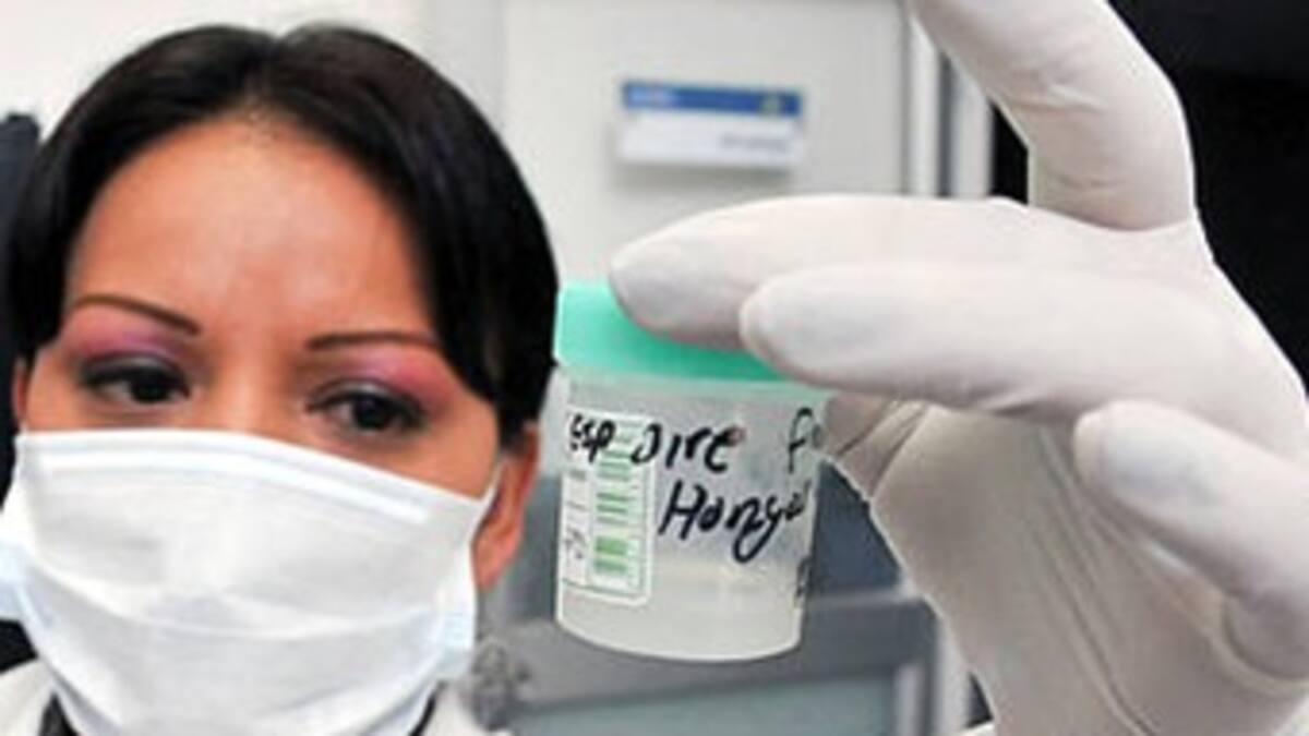 Diagnostique a tiempo la tuberculosis y salve su vida