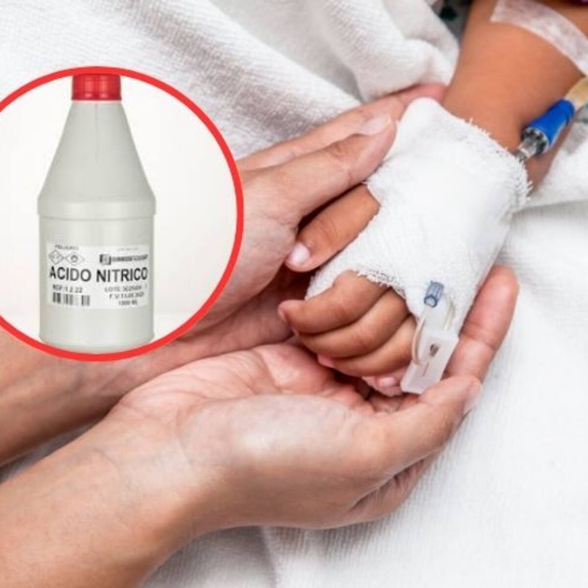 Santander: Niño tomó ácido nítrico al confundirlo con una Pony Malta. Su estado es crítico