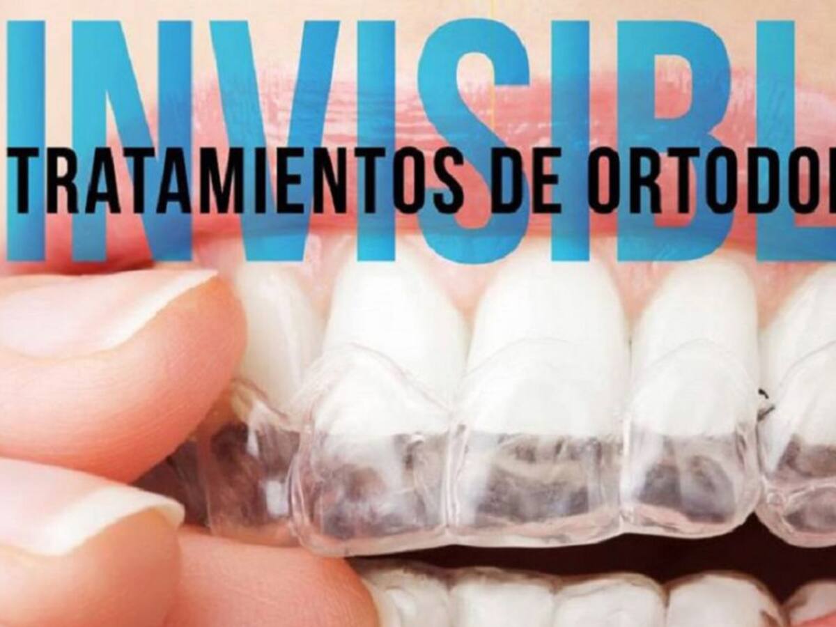 Ortodoncia invisible: un innovador proceso en la estética dental