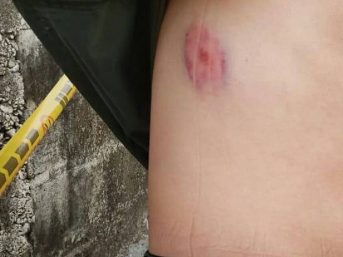 Un policía fue atacado por un hombre borracho en Anzá, Antioquia