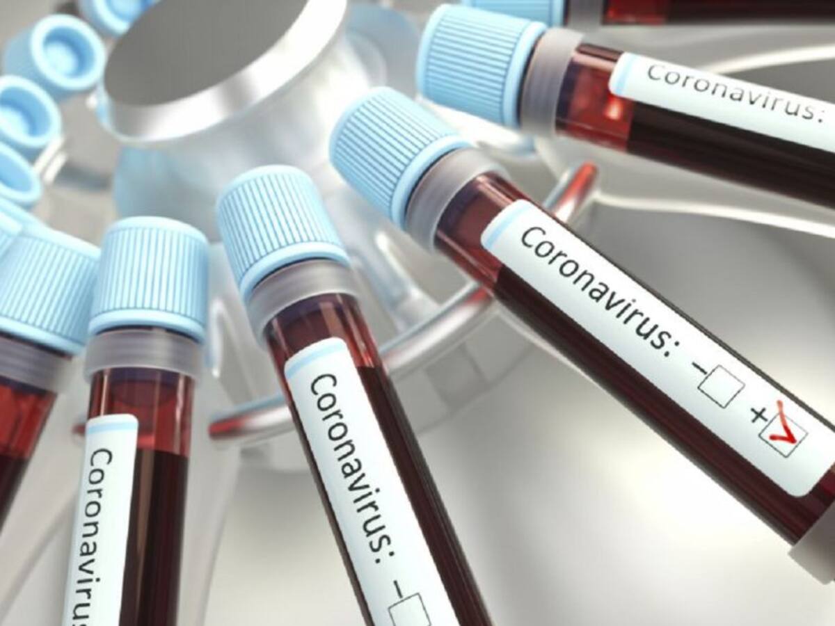Asciende a 11 los casos de coronavirus en Valledupar