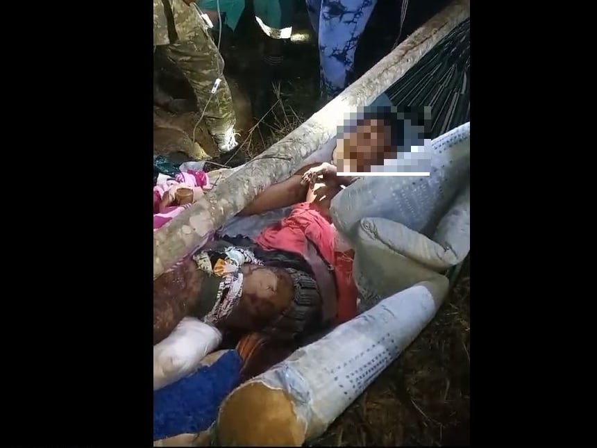 Campesino herido con mina antipersonal-foto cortesía