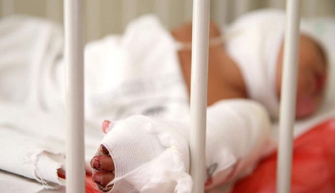 Quemados con pólvora 