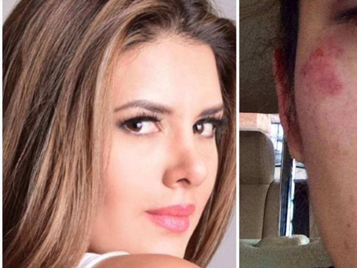 Actriz Juliana Daza denuncia golpizas de su expareja, Ricardo Torres