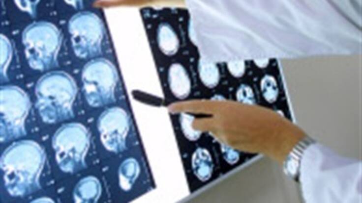 Neurólogo de Antanas Mockus dice que su paciente tiene el 100 por ciento de sus capacidades