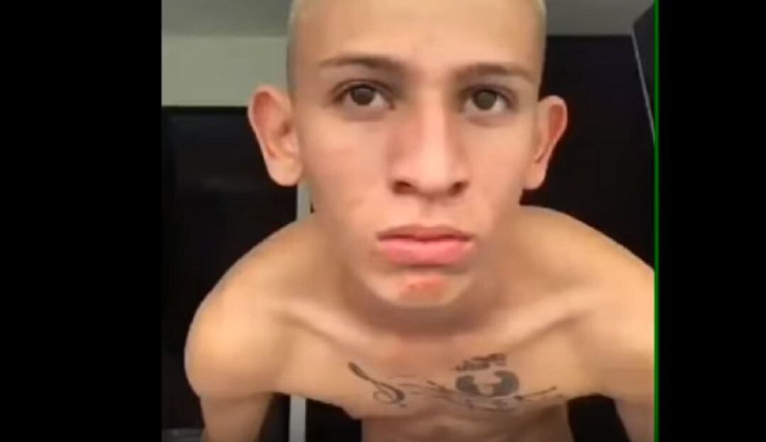 ¡Con piedras! Así atacaron al Instagramer 'La liendra'