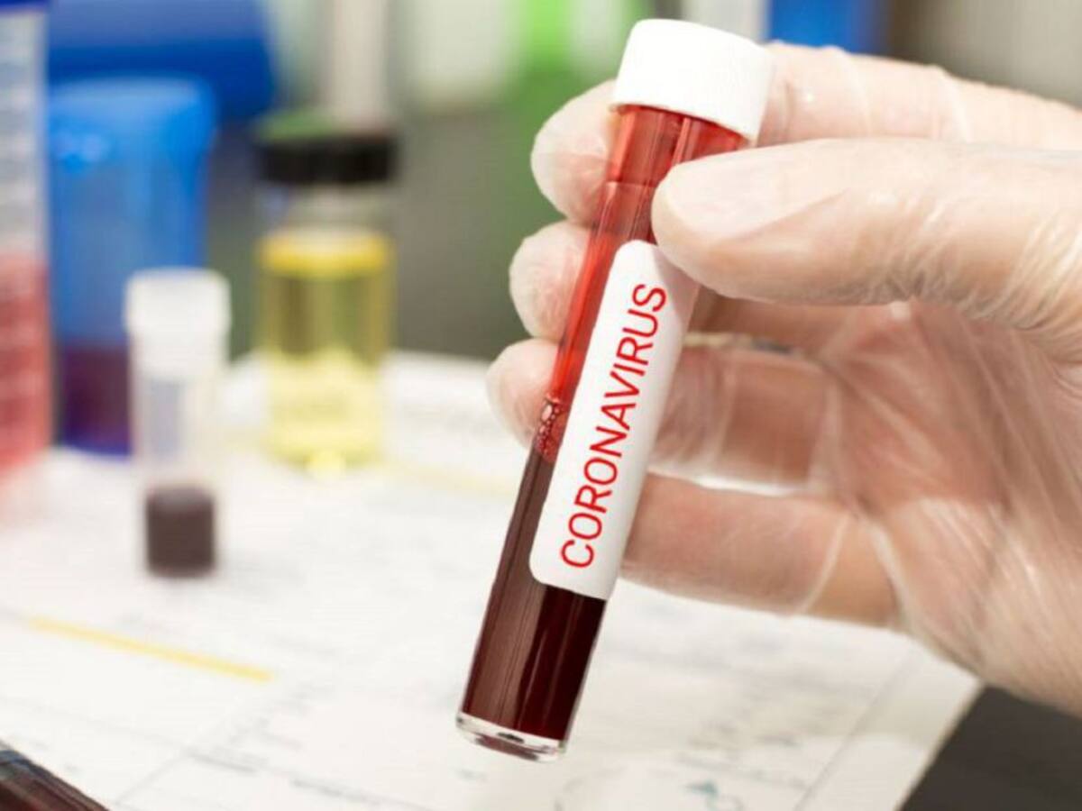 Preparan laboratorio de coronavirus en el Atlántico